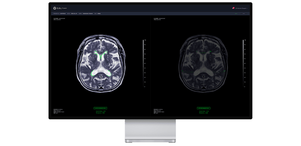 header-product-brainmetry