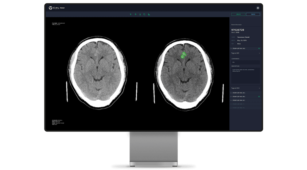 toppage-eirl-brain-segmentation-photo